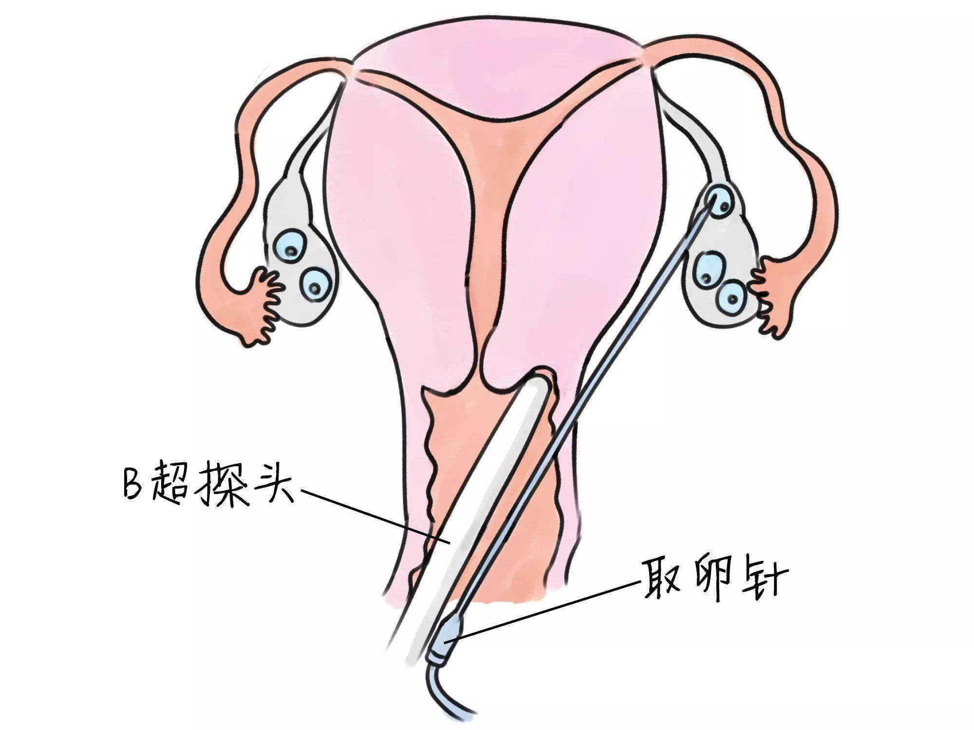 試管嬰兒怎么做的全過程需要多長時間,試管嬰兒制作全過程詳解，時間與實地執行考察方案,快速響應計劃解析_云版54.19.91